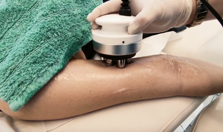 Θεραπεία 3D Lipo Cavitation Πώς Λειτουργεί